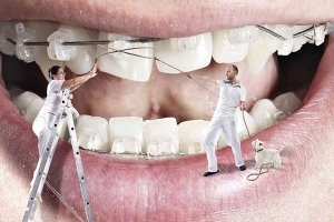 تا چه میزان امکان بازگشت عارضه‌های دهان و دندان پس از درمان ارتودنسی وجود دارد؟