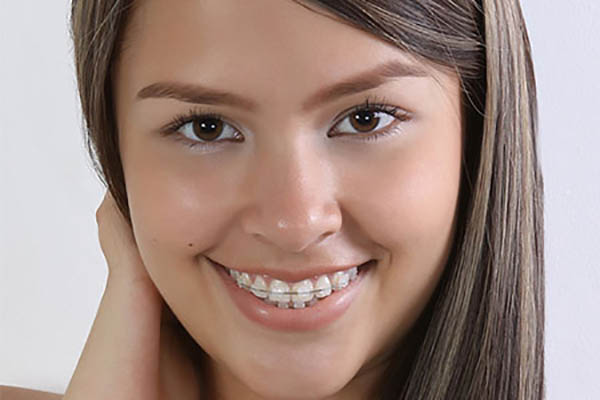 چگونه دندان‌های فاصله‌دار را به کمک ارتودنسی درمان کنیم؟