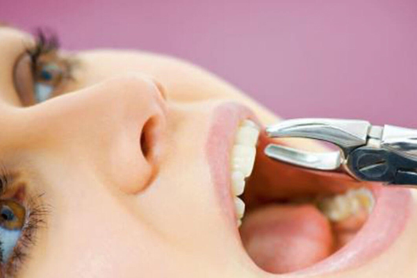 آیا با وجود عصب کشی دندان‌ها می‌توان اقدام به درمان ارتودنسی کرد؟